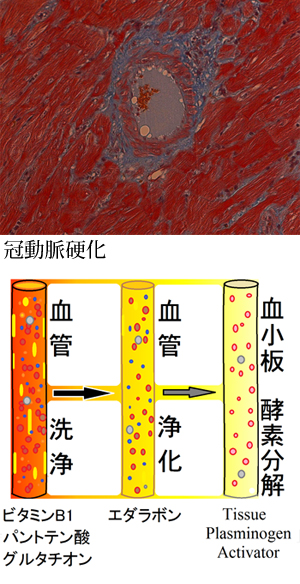 血管掃除