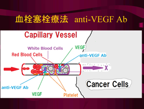 血栓塞栓療法